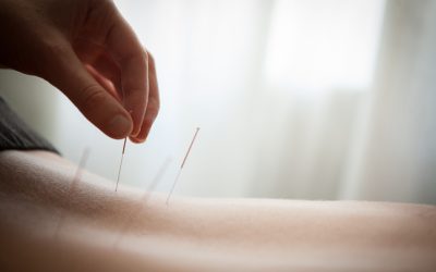 The Definitive Guide To Acupuncture and Its Benefits